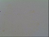 Echiniscus virginicus image