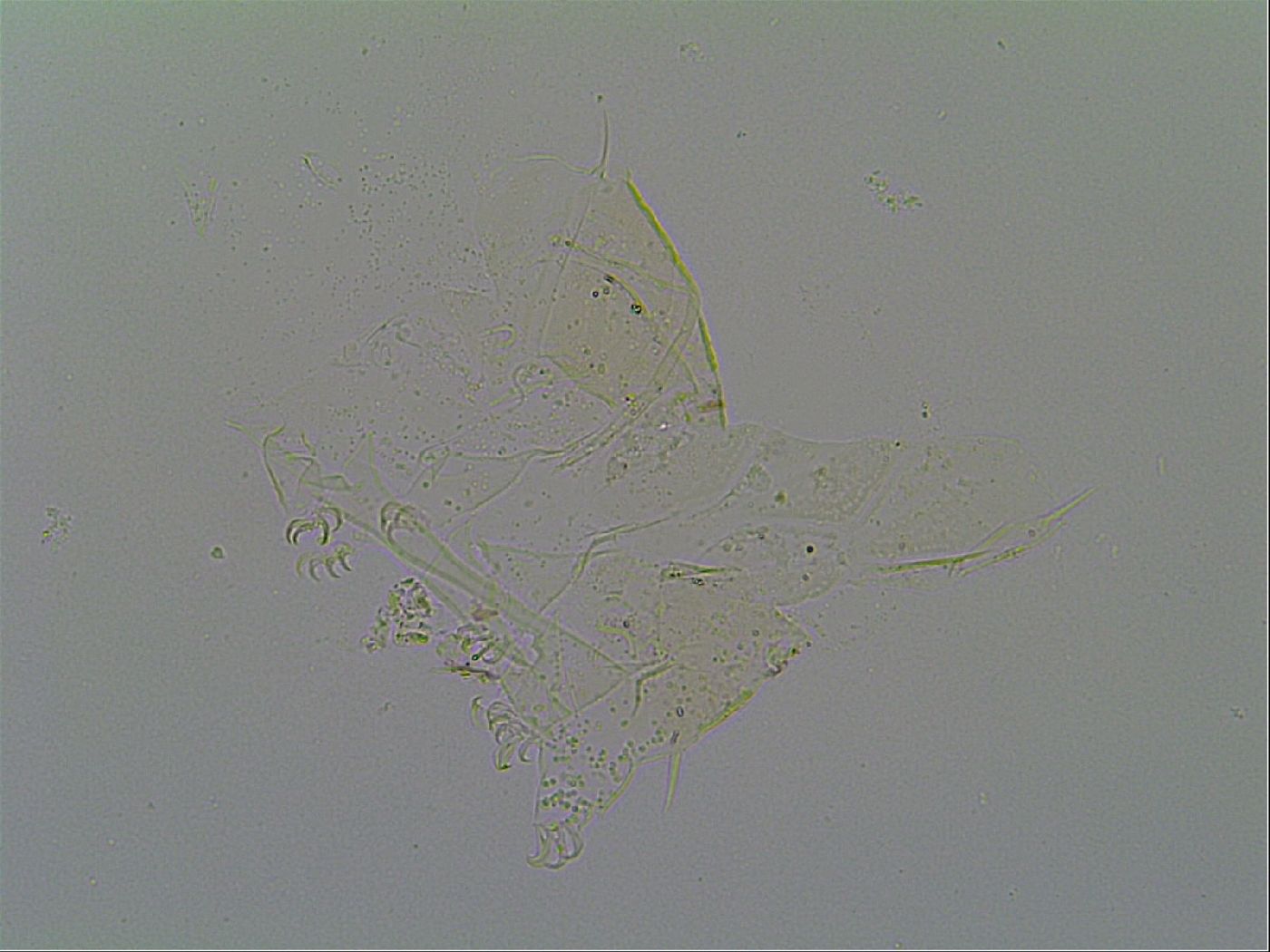 Echiniscus virginicus image
