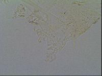 Echiniscus virginicus image