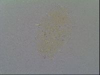 Echiniscus virginicus image