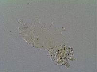 Echiniscus virginicus image