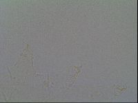 Echiniscus virginicus image