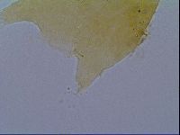 Echiniscus virginicus image