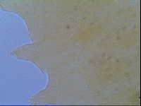 Echiniscus virginicus image