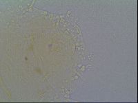 Echiniscus virginicus image