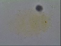 Echiniscus virginicus image