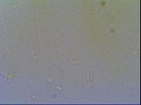 Echiniscus virginicus image