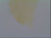 Echiniscus virginicus image
