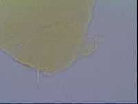 Echiniscus virginicus image