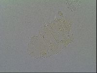 Echiniscus virginicus image