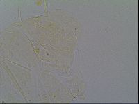 Echiniscus virginicus image
