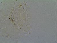 Echiniscus virginicus image