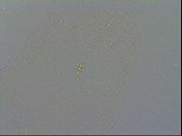 Minibiotus intermedius image