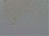 Minibiotus intermedius image
