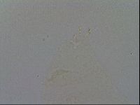 Minibiotus intermedius image