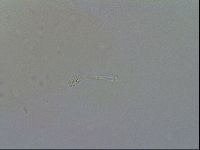 Minibiotus intermedius image