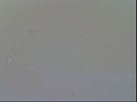 Minibiotus intermedius image
