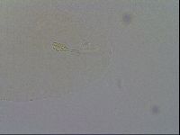 Minibiotus intermedius image