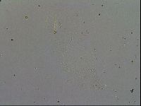 Minibiotus intermedius image