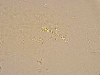 Minibiotus intermedius image