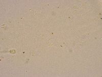 Minibiotus intermedius image