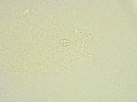 Minibiotus intermedius image
