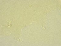 Minibiotus intermedius image