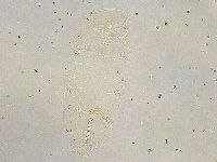 Minibiotus intermedius image