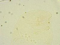 Minibiotus intermedius image