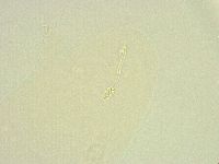 Minibiotus intermedius image