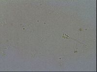 Minibiotus intermedius image