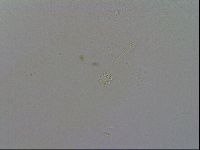 Minibiotus intermedius image