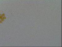 Minibiotus intermedius image