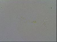 Minibiotus intermedius image