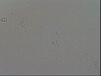 Minibiotus intermedius image