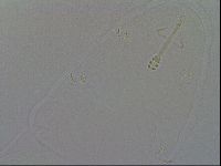 Minibiotus intermedius image