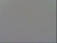 Minibiotus intermedius image