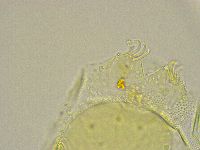 Pseudechiniscus novaezeelandiae image