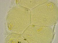 Media resource of Pseudechiniscus novaezeelandiae