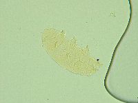 Pseudechiniscus novaezeelandiae image