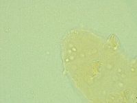 Pseudechiniscus novaezeelandiae image
