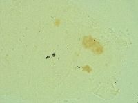 Antechiniscus lateromamillatus image
