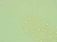 Pseudechiniscus novaezeelandiae image