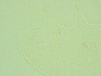 Pseudechiniscus suillus image