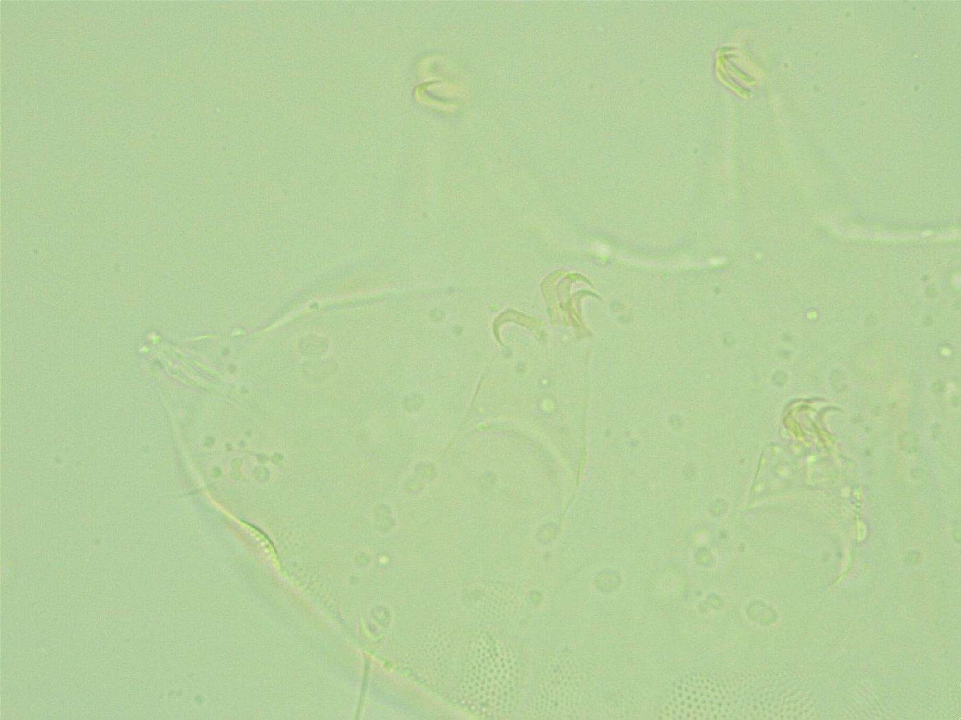 Pseudechiniscus suillus image