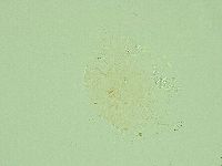 Antechiniscus lateromamillatus image