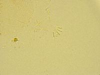 Antechiniscus lateromamillatus image