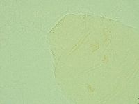 Pseudechiniscus suillus image