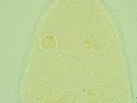 Pseudechiniscus novaezeelandiae image