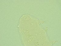 Pseudechiniscus novaezeelandiae image